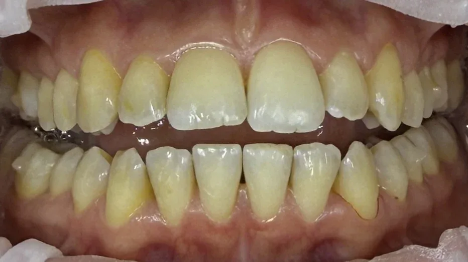 Pred ošetrením - testovacia fotografia 1