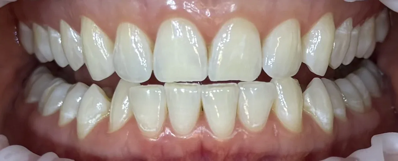 Po ošetrení - testovacia fotografia 3