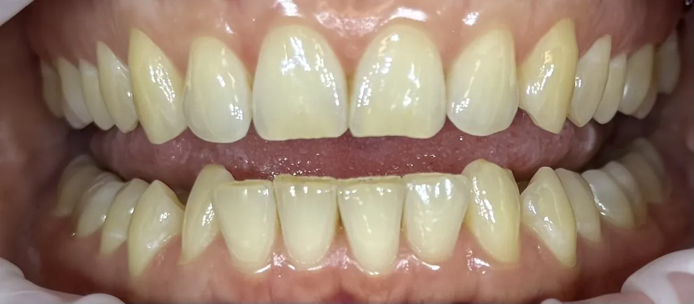 Pred ošetrením - testovacia fotografia 3