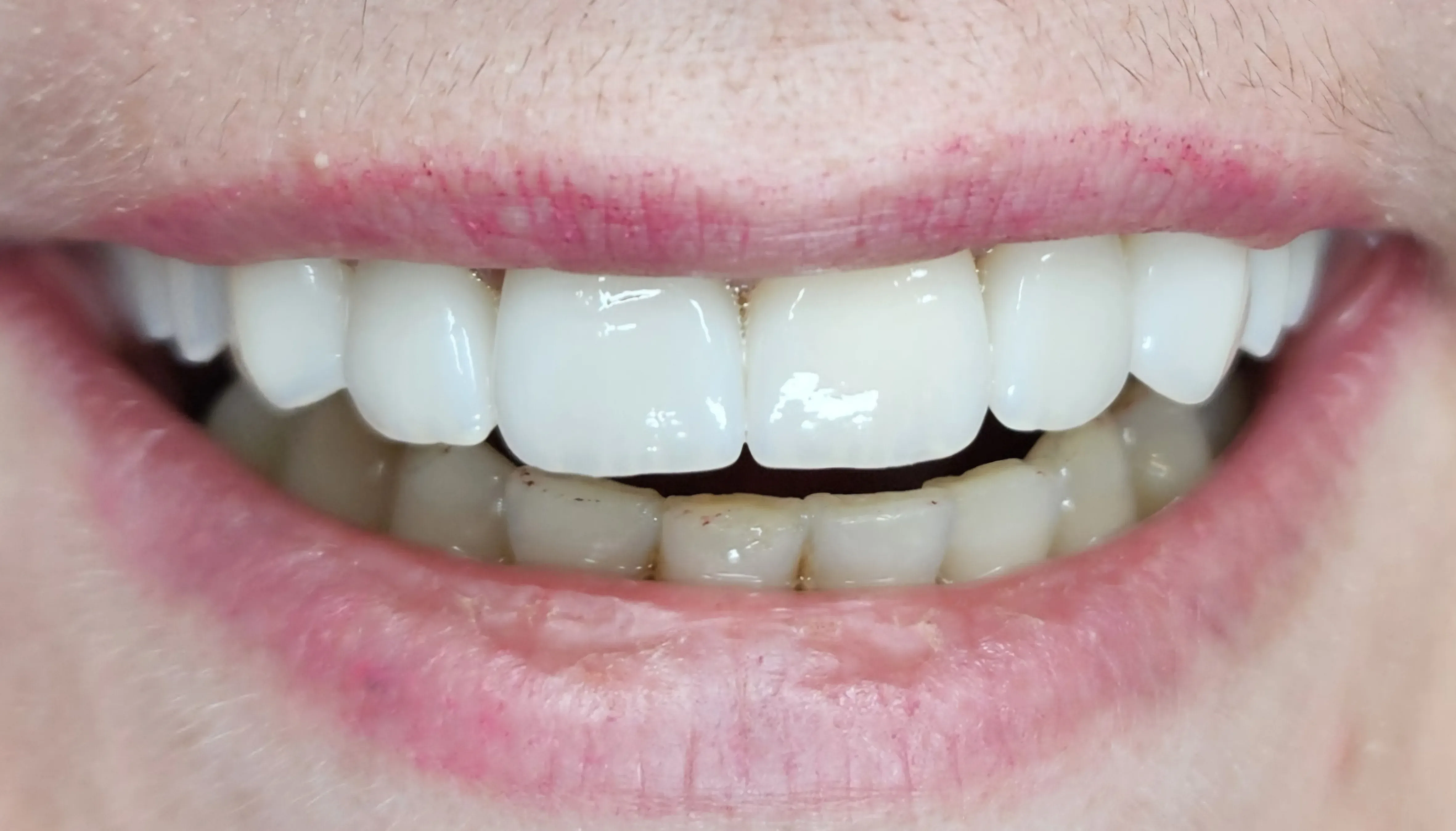 Po ošetrení - fotografia premeny 4