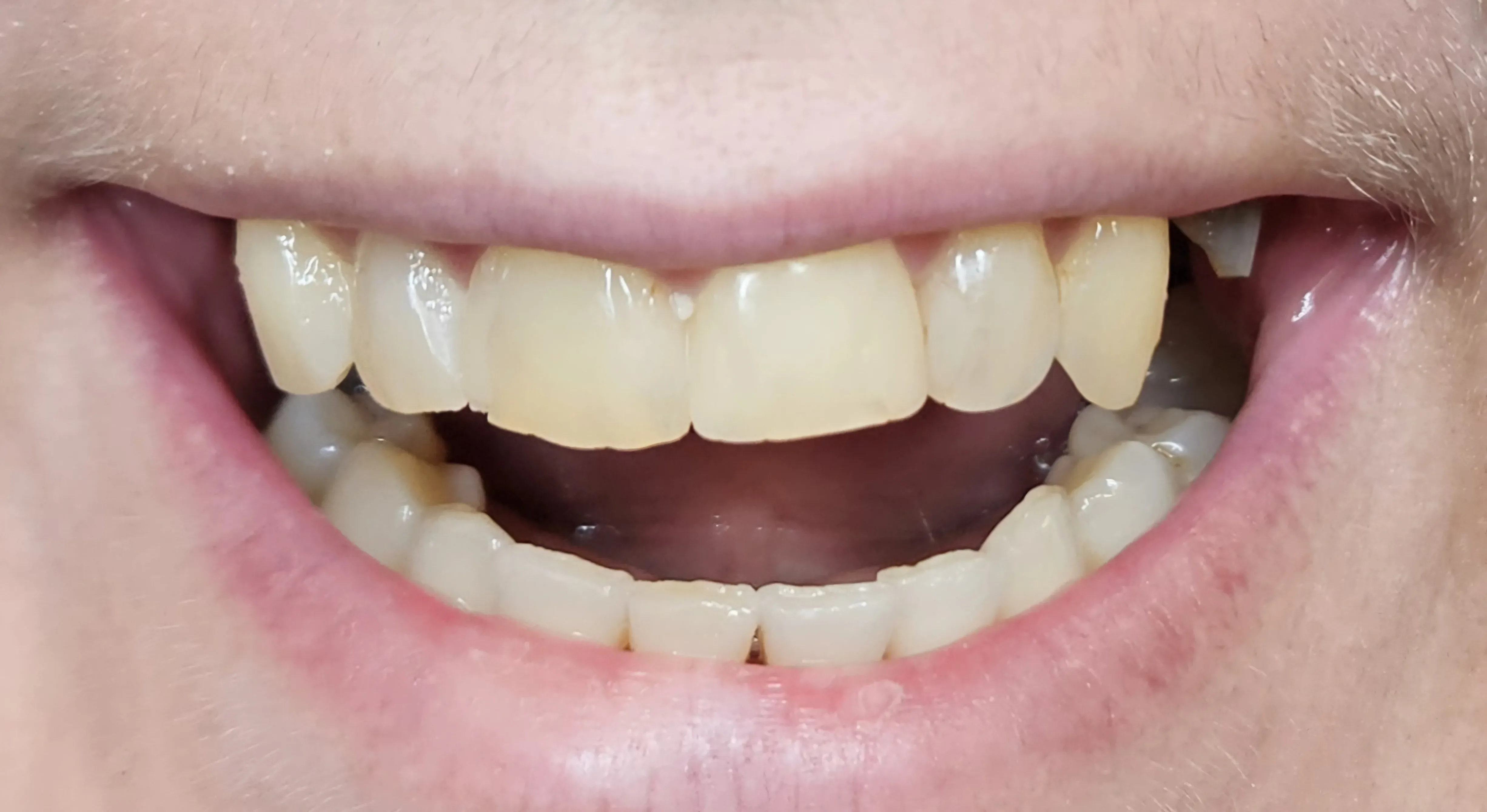 Pred ošetrením - fotografia premeny 4