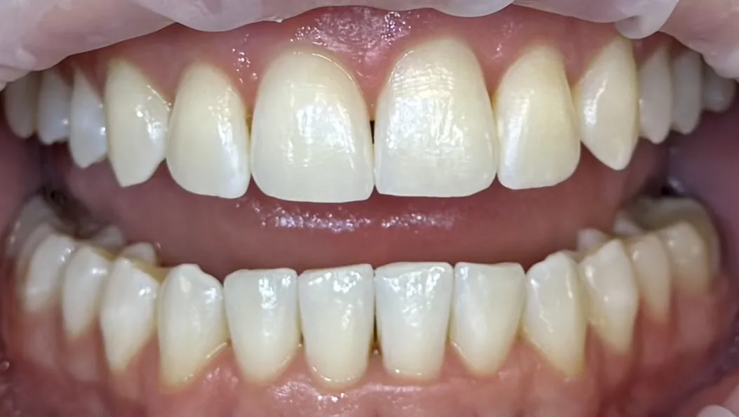 Po ošetrení - fotografia premeny 5