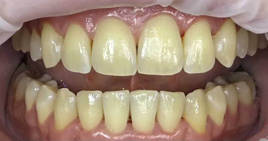 Pred ošetrením - fotografia premeny 5