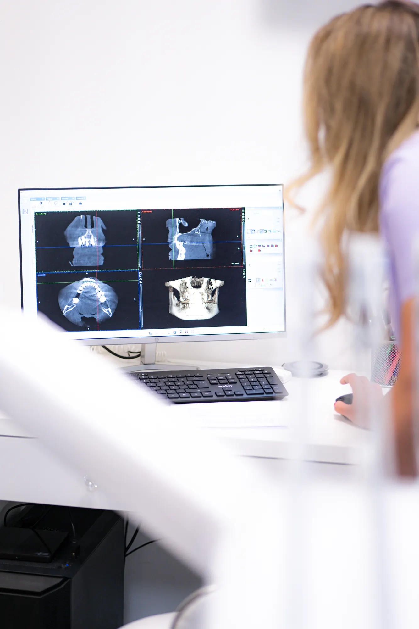 Plánovanie chirurgického a implantologického zákroku